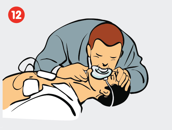 CardiAid stap 12, Continue CPR 
